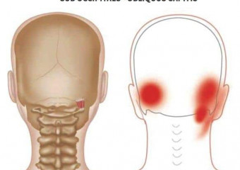 Dhimbja E Kokës Nga Tensioni